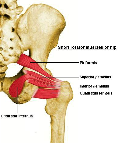 Ischial-femoral impingement: you have to know what it is to make the diagnosis and know how to treat it. How many times have you had a client come in with pain high up in the ischial area, often explaining that it feels like a high hamstring pull. Others come in and say they have deep gluteal pain, deep in the buttock near the “sit bones”. Often they do not have a “hamstring-type event” that could be the cause of this injury or pain. I see this “high hamstring” pain often in runners, mostly distance runners but in high velocity cutting sports as well. I see this one often, and it was a difficult fix until I recognized what it truly was and what was generating the pain and problem. Often the problem is at the quadratus femoris muscle. This muscle has an origin off of the ischial tuberosity and inserts into the trochantric interval. The problem arises when the space, the interval, between these bony prominences is closed causing the quadratus femoris to become compressed or pinched in the small space. This can occur from too much frontal plane drift of the pelvis (side shift/drift) and this is almost always met by a relative adduction of the femur. This adduction narrows the space. Frontal plane drift of the pelvis and adduction of the femur, as either genu valgum or a cross over gait, are highly suspicious culprits in getting to the bottom of this clinical entity. Do you know how to test and evaluate the quadratus femoris muscle ? How about the similarly functioning obturator externus, upper vastus medialis or iliac division of the gluteus maximus ? Can you reasonably tease them out on your physical examination? If you know the common motion amongst them all you will know why they all can be a culprit of the pain and impinging mechanism, and why in treating this problem you likely will have to evaluate and treat one or more of them since they all support external rotation of the femur especially in varying degrees of hip flexion, and thus are used eccentrically to a significant degree to control the rate and degree of internal rotation of the lower limb during contact phase of gait. Losing this control and compounding frontal pelvis drift (and thus femur adduction) will close off the interval for the ischium of the pelvis moving past the femur’s lesser trochanter. I know you have seen this problem in your clinics and gyms. Have you missed it and called it a hamstring tendonopathy, or have you nailed it ? It is out there, but you have to know something exists to recognize it, and to fix it. You have to recognize it and understand the pieces of the problem, the anatomy and the pathomechanics and understand what is going on in their gait that could be causing it. This is not a psoas related entity although that should remain on your differential list. This is not to be mistaken for a hamstring tear as I suggested earlier, look at this study’s findings, it is not the same entity, although it is possible to have both simultaneously: “Abnormalities of the quadratus femoris muscle included edema (100%), partial tear (33%), and fatty infiltration (8%). The hamstring tendons of affected subjects showed evidence of edema (50%) and partial tears (25%).” - Torriani (3) I cannot find any research out there correlates weakness of the gluteals and of the lateral chains with weakness of this quadratus femoris muscle and its synergists with femur adduction and cross over gait styles in this clinical impingement phenomenon. These components are closely related and functional in my experience. Certainly I cannot be the first to entertain this conceptual layered idea with the cross over gait /frontal plane drift predisposers. So, please come forward if you have seen the same things and had similar successes, lets compare notes and share your nuances in caring for it. There is something here though, because my clients progress nicely when the multiple muscles that support this spiral-natured external rotation are cleaned up, active, strong and paired nicely in a motor pattern that stacks the foot, knee, hip and pelvis reducing femoral adduction and in the functional components that reduce frontal plane drift which I have discussed here many times on the gait guys blog (type in “cross over gait” in the blog search box). Dr. Shawn Allen, the gait guys references: 1. Am J Orthop (Belle Mead NJ). 2014 Dec;43(12):548-51.Ischiofemoral Impingement and the Utility of Full-Range-of-Motion Magnetic Resonance Imaging in Its Detection.Singer A1, Clifford P, Tresley J, Jose J, Subhawong T. 2. Magn Reson Imaging Clin N Am. 2013 Feb;21(1):65-73. doi: 10.1016/j.mric.2012.08.005. Epub 2012 Oct 13.Ischiofemoral impingement.Taneja AK1, Bredella MA, Torriani M. 3. AJR Am J Roentgenol. 2009 Jul;193(1):186-90. doi: 10.2214/AJR.08.2090.Ischiofemoral impingement syndrome: an entity with hip pain and abnormalities of the quadratus femorismuscle.Torriani M1, Souto SC, Thomas BJ, Ouellette H, Bredella MA. 4. J Bone Joint Surg Br. 2011 Oct;93(10):1300-2. doi: 10.1302/0301-620X.93B10.26714. Ischiofemoral impingement. Stafford GH1, Villar RN.