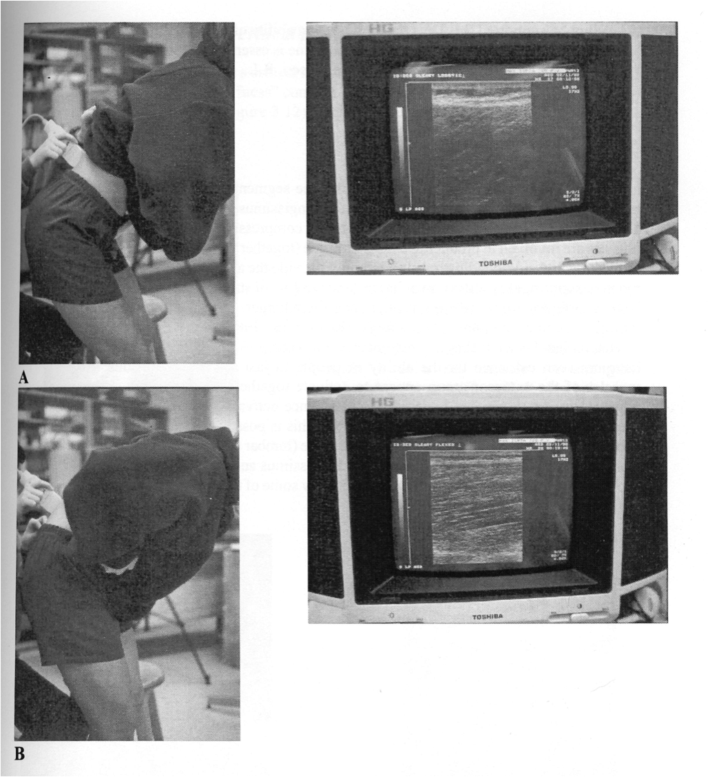 tumblr_mzoo71gBTf1qhko2so2_r1_1280.png