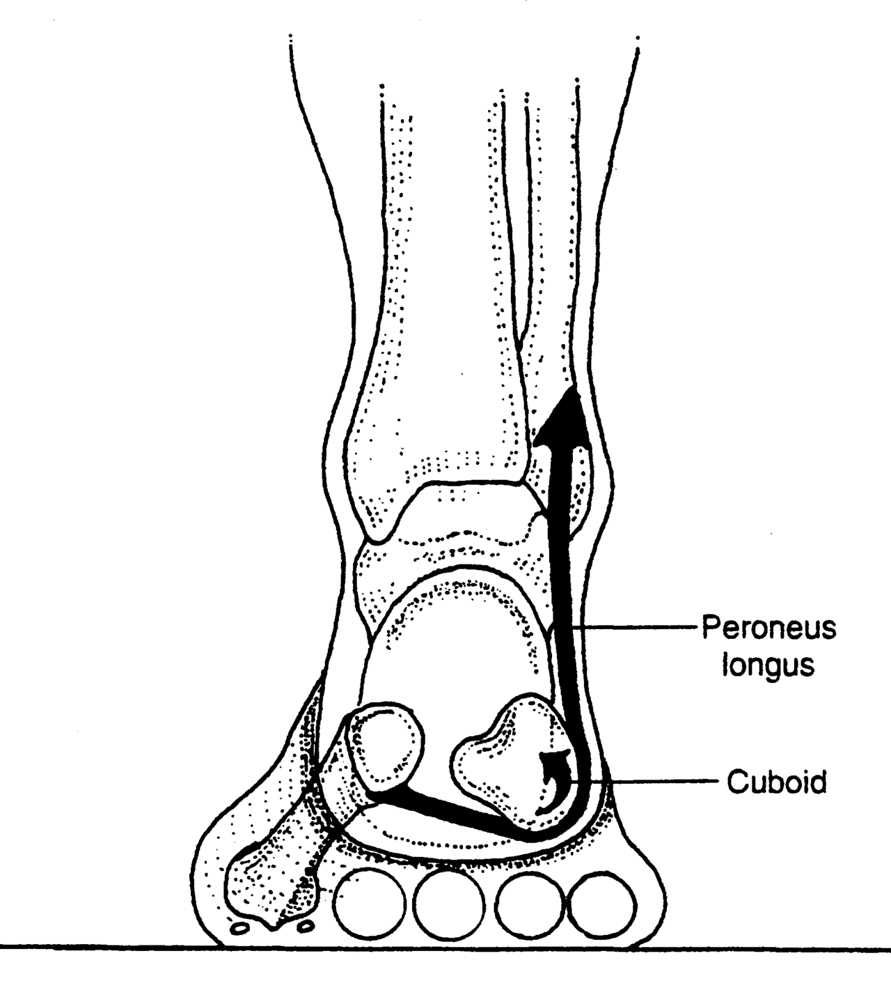 Supination, anyone? The importance of the calcaneocuboid locking mechanism. Pronation gets all the press; but what about its yin counterpart, supination ? There could not be one without the other. Pronation is dorsiflexion, eversion and abduction of the foot. It provides shock absorption. Supination is plantar flexion, inversion and adduction. It make the foot into a rigid lever so we can GO (Like in Theo Selig’s “Go Dig Go”. OK, I have been reading that to my kids alot lately…) Locking of the lateral column of the foot (4th and 5th metatarsal, cuboid and calcaneus) is a necessary prerequisite for normal force transmission through the foot and ultimately placing weight on the head of the 1st metatarsal for proper toe off. Locking of the lateral column minimizes muscular strain as the musculature (soleus, peroneus longus and brevis, EHL, EDL, FDL and FHL) is usually not strong enough to perform the job on its own. The peroneus longus tendon wraps around the cuboid (and the brevis attaches to the base of the 1st metatarsal) on its way to insert onto the base of the 1st metatarsal. When it contracts, it dorsiflexes and everts the cuboid, which, along with the soleus (which plantar flexes and inverts the subtalar joint) allows dorsiflexion of 4th and 5th metatarsals and “locks” the lateral column. Without this mechanism, there is no locking. Without locking, there is no supination. Without supination, there is little rigidity and inefficient propulsion. The calcaneo cuboid locking mechanism. Another cool thing you learned about gait today from The Gait Guys.
all material copyright 2012 The Homunculus Group/The Gait Guys. All rights reserved. If you use our stuff without asking us, we will find you and put valgus wedges in all your shoes.