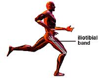 Chronic ITB -ITBand tightness in a runner. What is the real issue and solution ?
We get dozens of emails daily, and we try to anonymously post a good case weekly.
Dear Drs. Waerlop and Allen:
I am hoping that you will be able to help me, by referring me to the right professionals.
I am a 45 year old woman who has been plagued by what doctors have told me is Iliotibial band friction syndrome for the past three years. When my injury first occurred, I was running approximately 4 miles three to four times per week. Most of the time, I ran in the woods, but I also ran in the street.
When it first occurred, I walked home and rested my legs for two weeks. After resting it, I learned that if I wore compression pants, I was able to run for 3 miles with no pain. So, I cut back on my running and endured that distance for a while. Eventually, it became so bad that I could not run two miles, so I decided to go to the doctors.
The first doctor I went to for the problem told me to stretch my Iliotibial band and strengthen it by doing the four way leg exercise. I did exactly as I was told, but to no avail. I went back to the doctor and he could not understand why I was not getting better. Since it became apparent to me that seeing him was fruitless, I did not go back a third time. He told me that the problem would resolve itself within time.
For the next year, I self-treated. I stretched, strengthened my hips and iced my knee. At times, I could run 3 to 4 miles in the woods wearing a brace. As soon as I felt any pain, I stopped running, and walked to my destination. I would rest my leg again for a few weeks, and start back to running gradually, i.e. .5 miles every other day. I took spin class two or three days per week to keep my cardio level up. Interestingly, biking has never bothered my knee.
Last summer, it became so bad that I could not run .2 of a mile. In September, I walked about 4 miles in Philadelphia in flip flops (I can hear you gasping now), and my knee began to hurt (you are probably saying no wonder!). That was the first time my knee hurt while walking. It was so sore for the next few days that the pain woke me up at night. Shortly thereafter, I was walking and my back started to hurt so I went to another doctor.
The second doctor I went to told me to do a single leg squat and said you have Iliotibial band friction syndrome. He prescribed physical therapy. I have been going to physical therapy since the beginning of October. I returned to running slowly and eventually I was able to run 20 minutes on the treadmill at a level between 7.4 and 7.6. I ran three days per week.
I have also endured the Graston Technique and ART twice a week since November. My physical therapist feels that it was successful in breaking up my scar tissue. I can foam roll my Iliotibial band with both legs in the air without any pain.
Yesterday, I tried running outside. I ran on the flattest road I could find, but was unable to make it a mile. I stopped running as soon as I felt the pain (similar to a throbbing pain) on the outside of my knee and walked home. I iced it and took Advil. I went to physical therapy today, and she cannot understand why I cannot run for one mile outside. She believes I need to see another doctor for another opinion.
Do you know of anyone in the Philadelphia area who would provide me the type of care that you provide to your patients? I found you on Facebook (I am Nellie Eplin) and find you fascinating.
I really want to get this fixed. I want to run for the rest of my life. It makes me a better person.
I appreciate all of the help that you are able to provide.
Best regards,
E.L.
_______________________________________________
Response from The Gait Guys:
Dear E.L. : ITB problems usually, but not always, occur from Weak gluteal support or from factors that allow or promote too much internal spin of the limb. Sadly the typical response people get are the same as you heard, stretch the ITB out and foam roll. There is a reason this is frequently fruitless to resolve your issues. The ITB mechanism can shorten because there is weakness somewhere in the limb and internal spin and frontal plane stability is lost. The internal spin issues can come from flat feet, hyper pronating, tibial torsion issues and valgus knees to name a few let alone general eccentric and isometric weakness of the muscles controlling internal spin rate (glutes and medial quads for example) .
The TFL-ITB are internal rotators, provide stability through limb rotation and provide some lateral stability. When the gluteals get weak you lose some of the lateral plane stability (mostly gluteus medius) and you lose some of the ability of the gluteals (iliac div. of g. maximus and posterior g. medius) to control rotation (eccentrically control the rate of internal spin). A few weeks back we did a several part series on the functions of the gluteal, here is the link of the first one & the second one and their effect on the IT Band-TFL mechanism.
We would start with reading these 2 blog posts and then go back to the 3 part series on the Cross Over Gait which you can find here on our Youtube channel .
Without an examination we are guessing but perhaps the 2 blog posts and investigating these 3 videos we did will help you to look at Cross over gait issues which can be a big component of excessive internal spin. Within the videos you will see some exercise skills that might help you.
Good luck, We are in Chicago and Colorado. We do not know of anyone that does our kind of work in your town. Sorry
Good luck and keep in touch with us regarding your progress and discoveries, in the mean time investigating our ideas above rethinking the stretching - foam roller approach for the brief time might help you.
Shawn and Ivo, The Gait Guys …. helping solve one unresolved case at a time.
* (in all case discussions our disclaimer applies, available on our website).