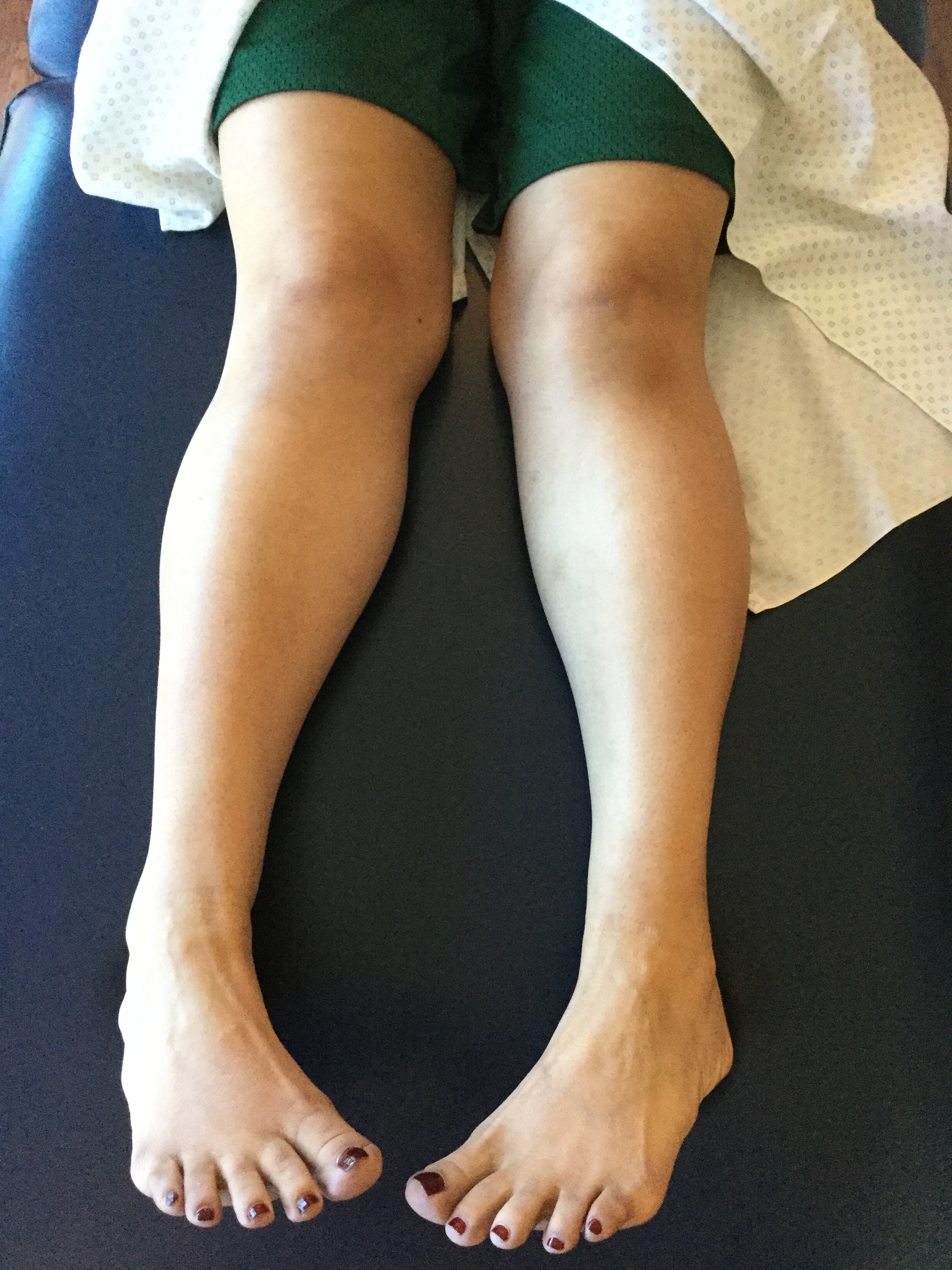 Perfecting Your Point (aka Ankle Plantarflexion) – Barefoot Strong