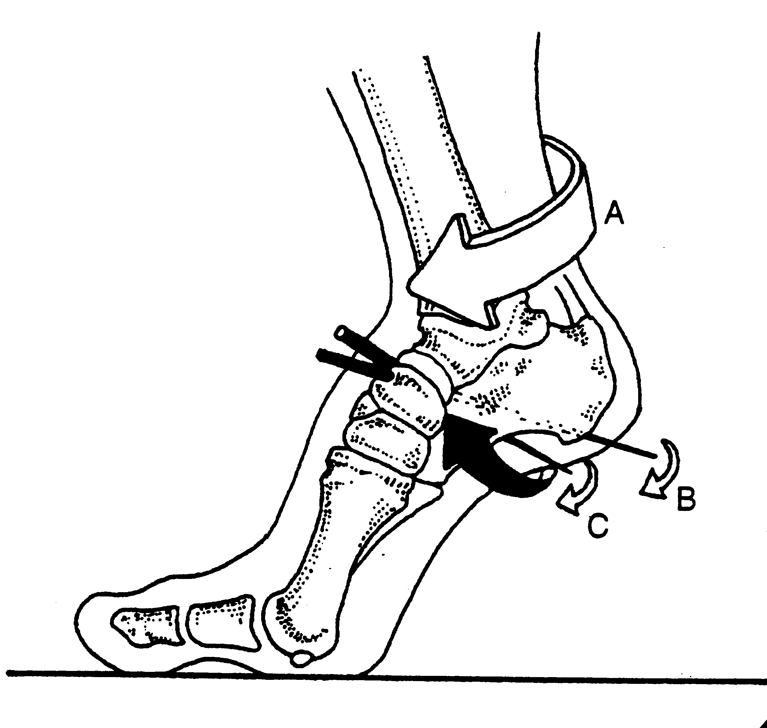external leg rotation supination.gif