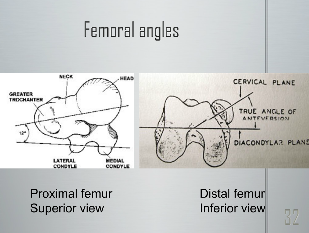 NO hip internal rotation? Forget the glutes, have you looked at the femur? — The Gait Guys NO hip internal rotation? Forget the glutes, have you looked at the femur? — The Gait Guys
