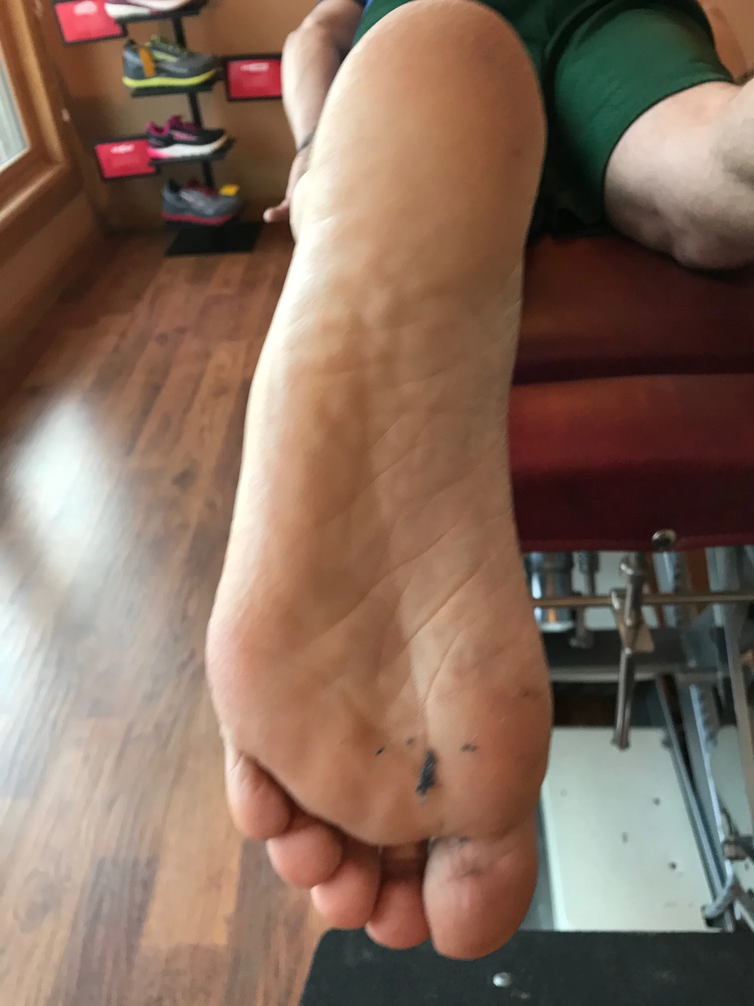 less adductus but still present