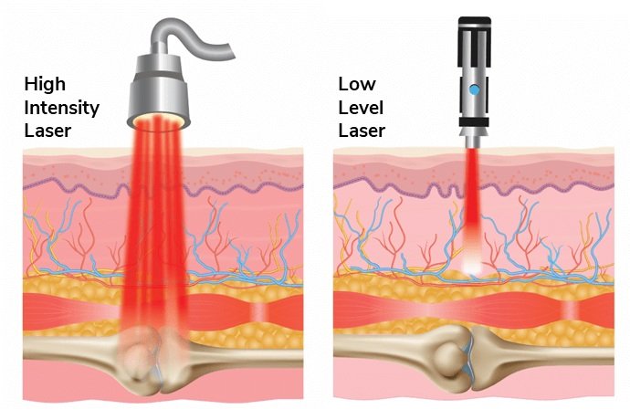 Laser Therapy Light