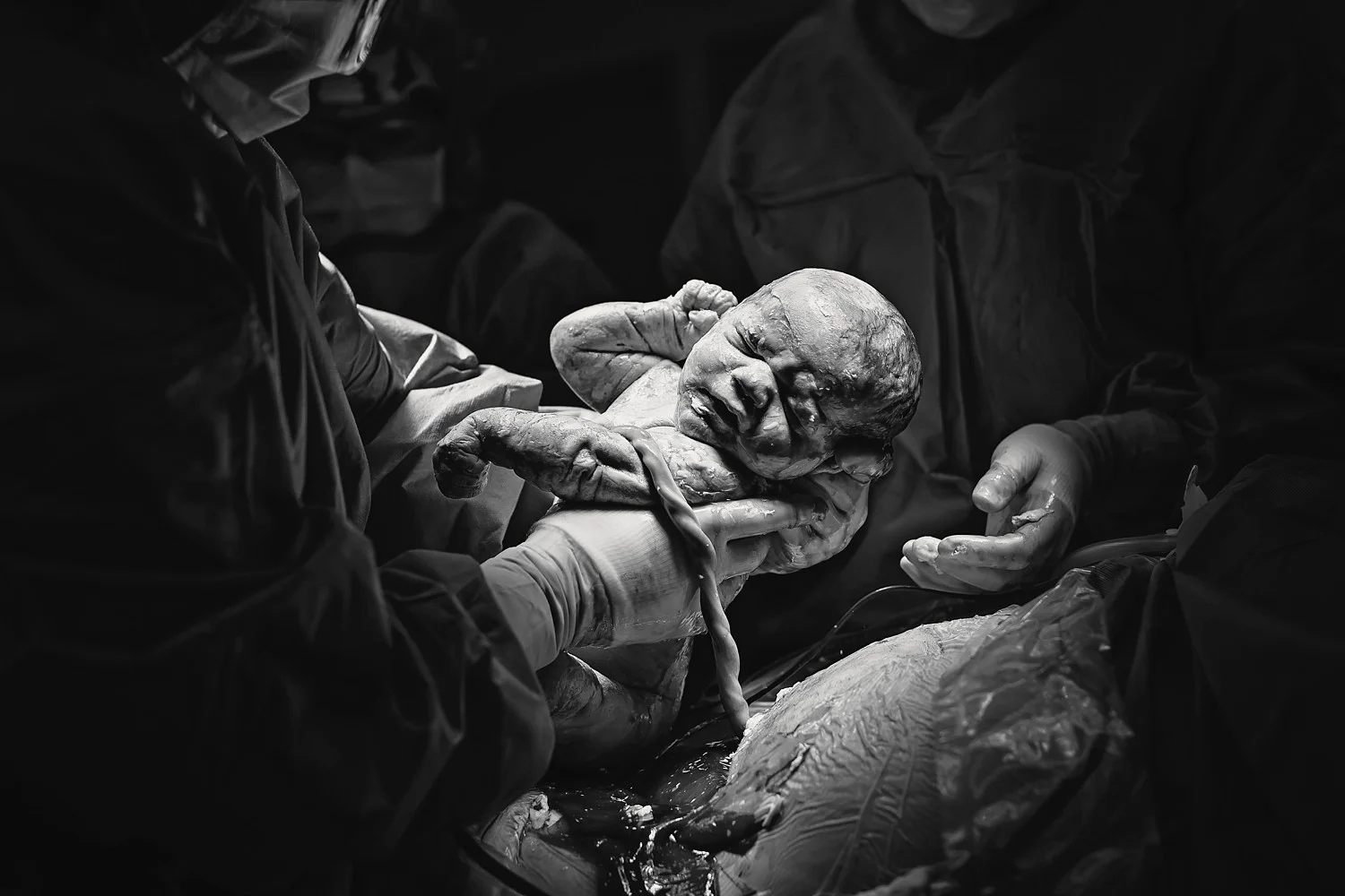(C) 2016 Michelle Garey : Denver Birth Photographer
