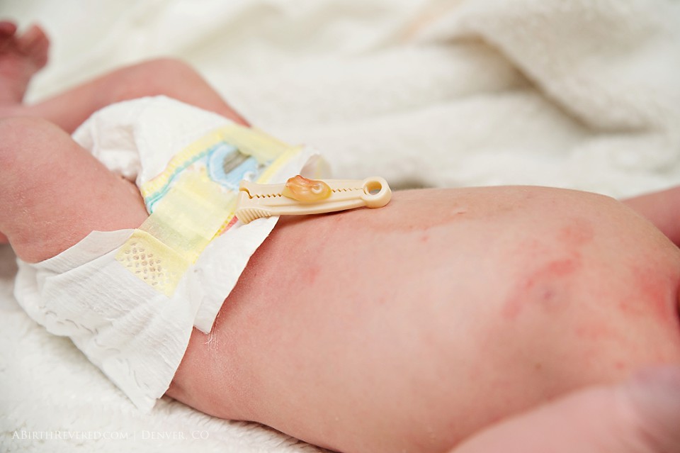 (C) 2016 Michelle Garey : Denver Birth Photographer