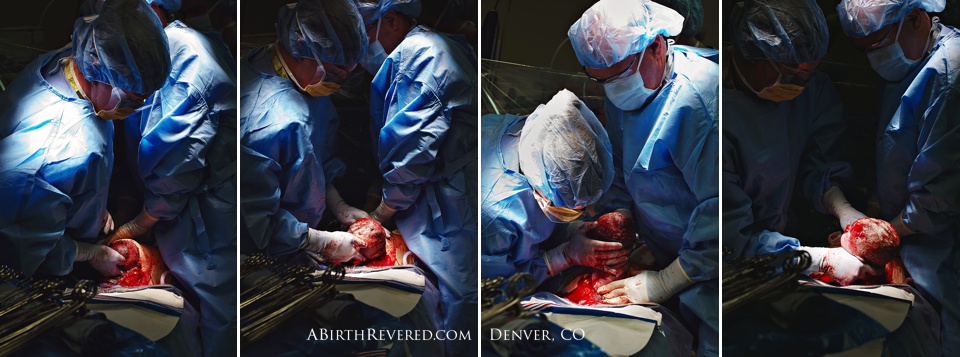 (C) 2016 Michelle Garey : Denver Birth Photographer