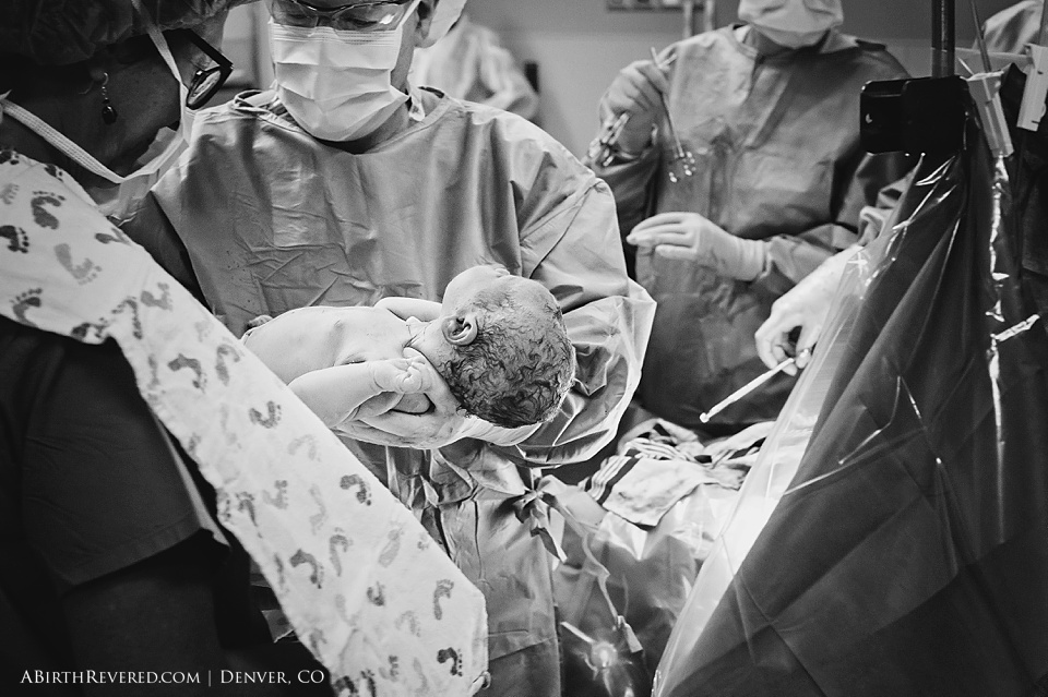 (C) 2016 Michelle Garey : Denver Birth Photographer