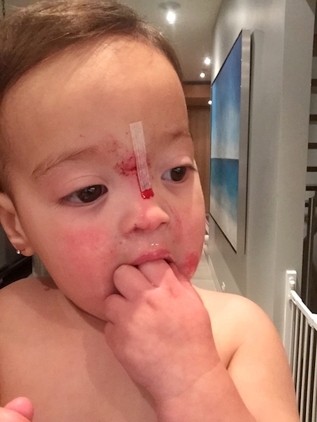 My poor baby :(