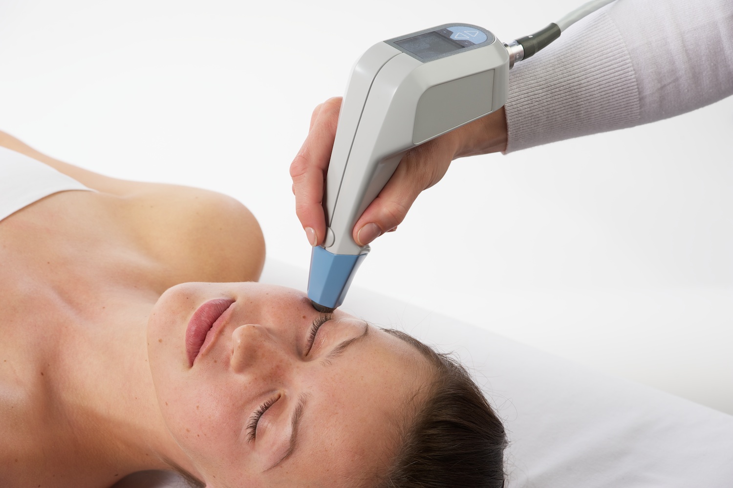 BTL EXILIS™ TREATMENT ON FACE