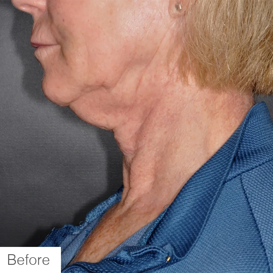 Neck01-a.jpg
