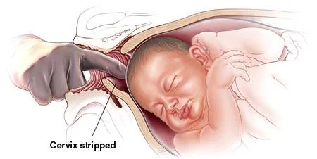 cervix stripped.jpg