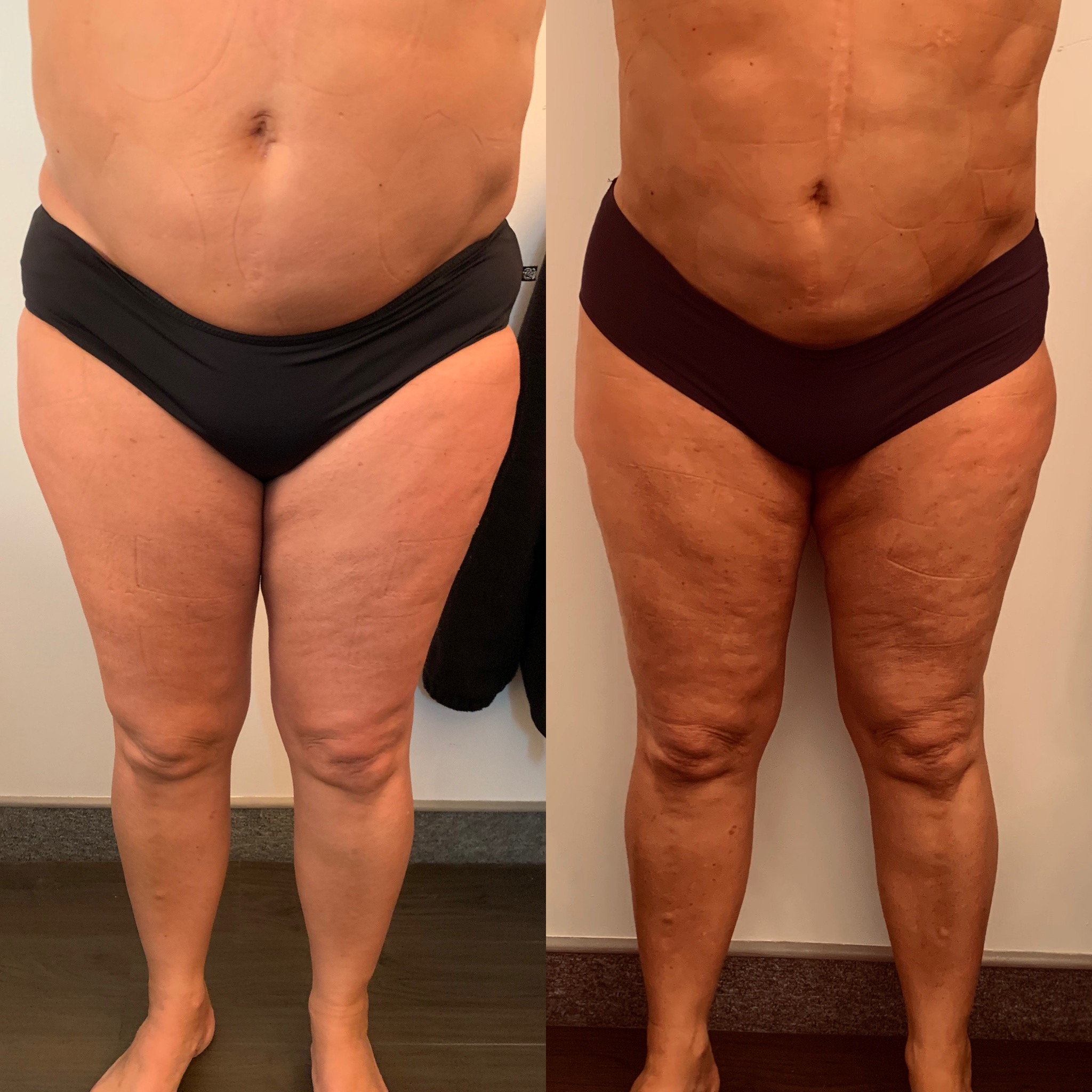 Slimming, Strength and Contouring is the Goal with this Gal