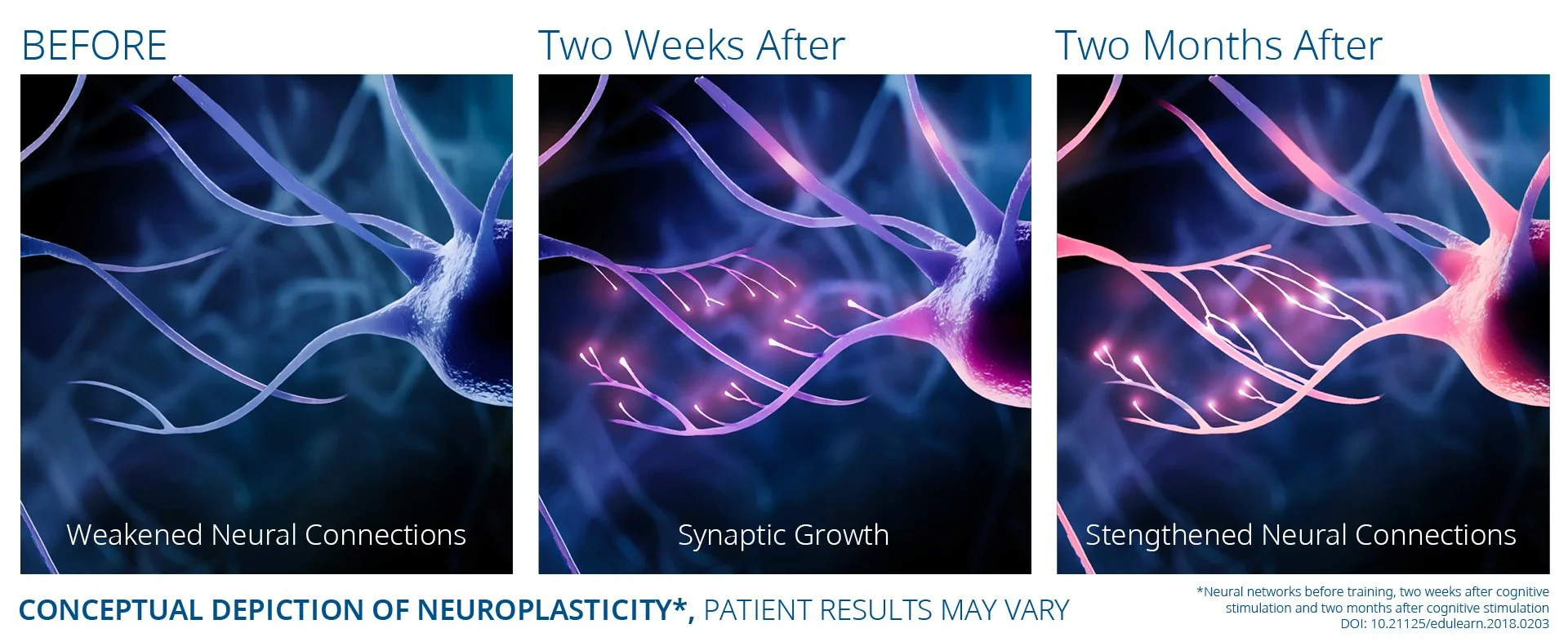 Exomind_PIC_Ba-card-Neuroplasticity-002_ENNA100.jpg