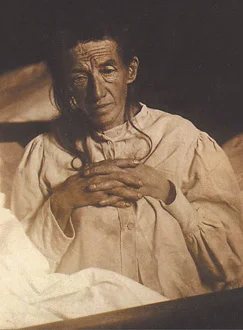 Auguste Deter, first person diagnosed with Alzheimer's disease