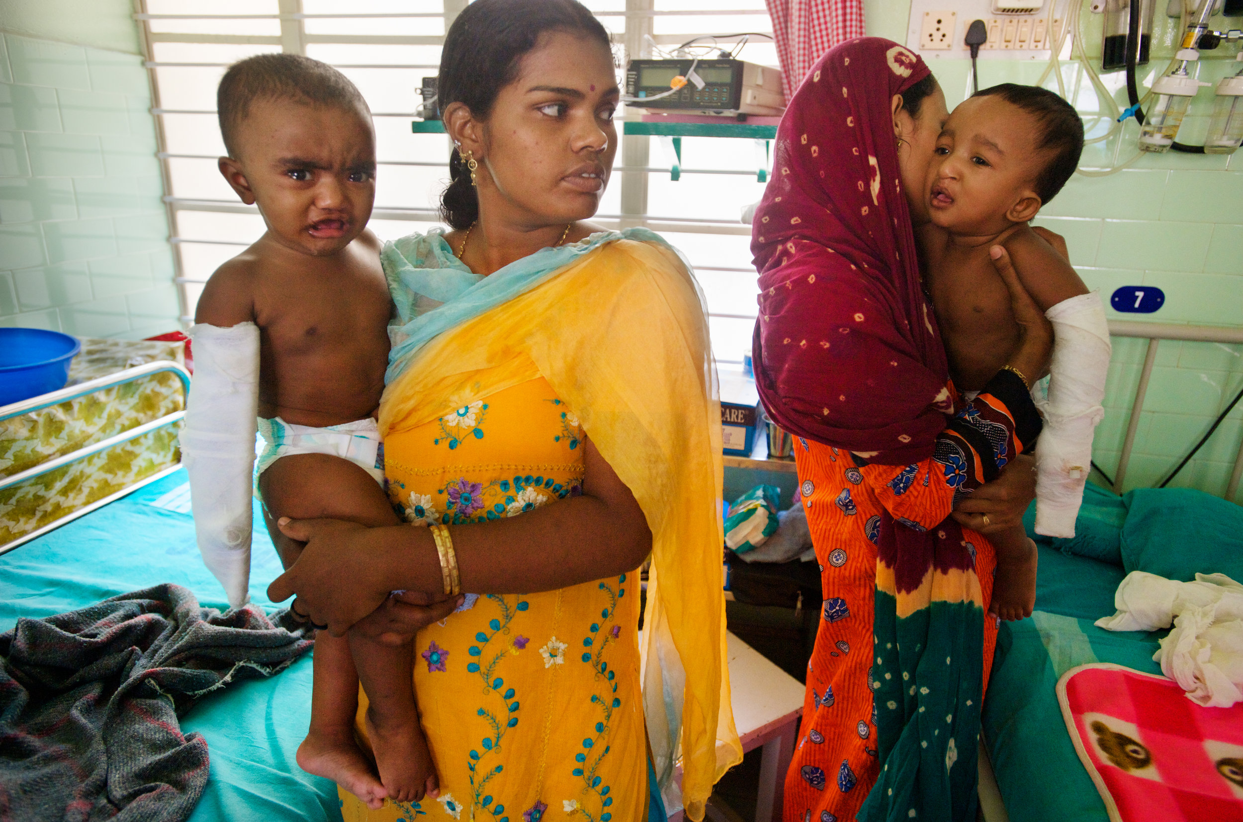 Post_Operation_Smile_Train_Kerala_India_2010.jpg