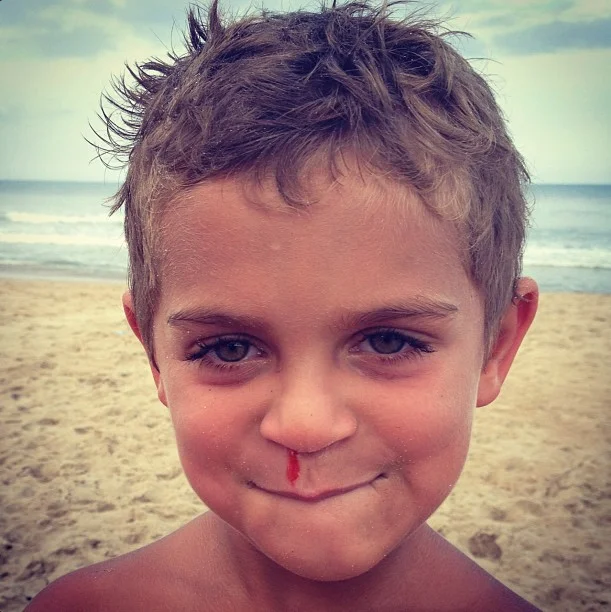 Bloody Noses and Memories