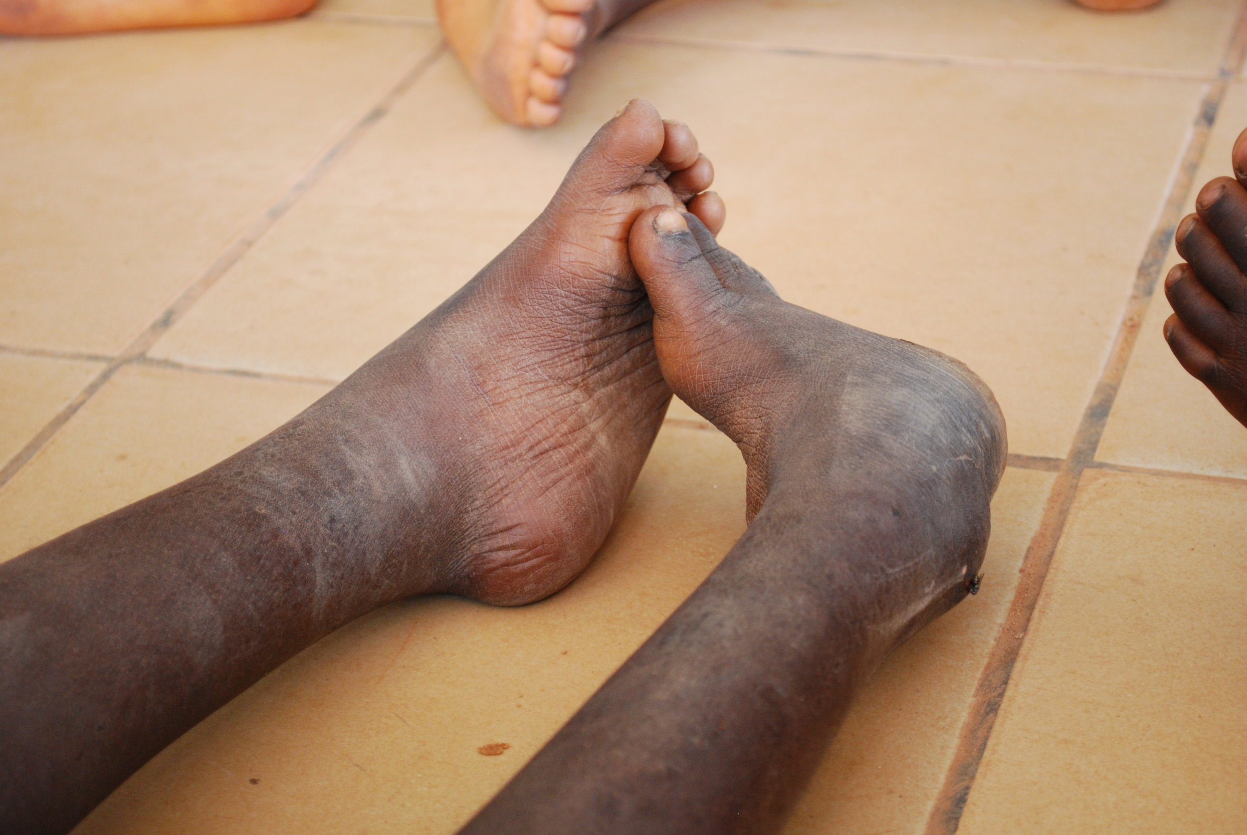 Photo credit: miracle feet