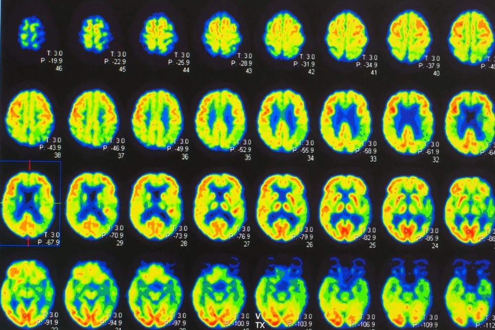 A Big Gift to UC San Diego is the Latest Philanthropic Push to Better Understand Psychedelics