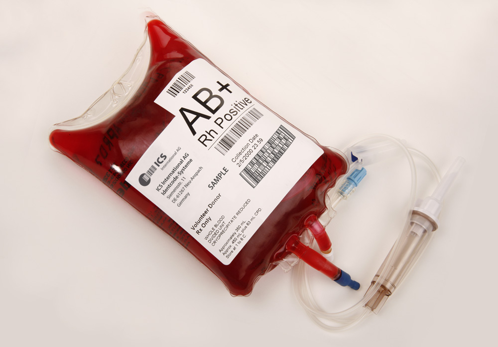 A filled blood bag. (Credit: ICSident/Wikimedia Commons under CC-BY-SA 3.0 )