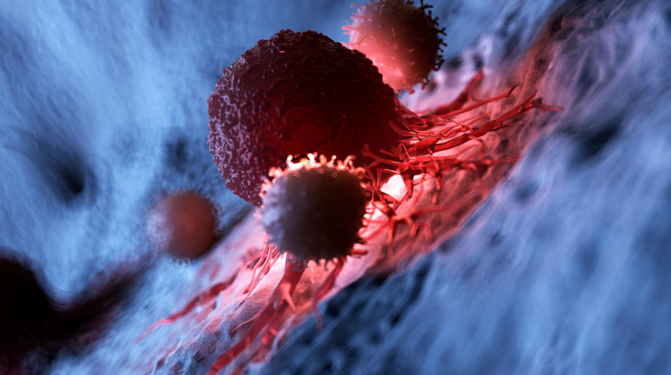 Inflammation’s Edge: CIRS, Cancer, and the Hidden Connection