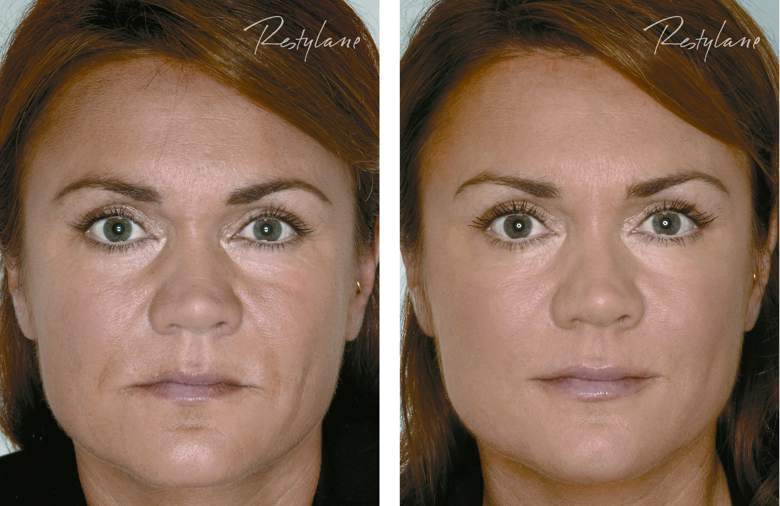 Before and after treatment