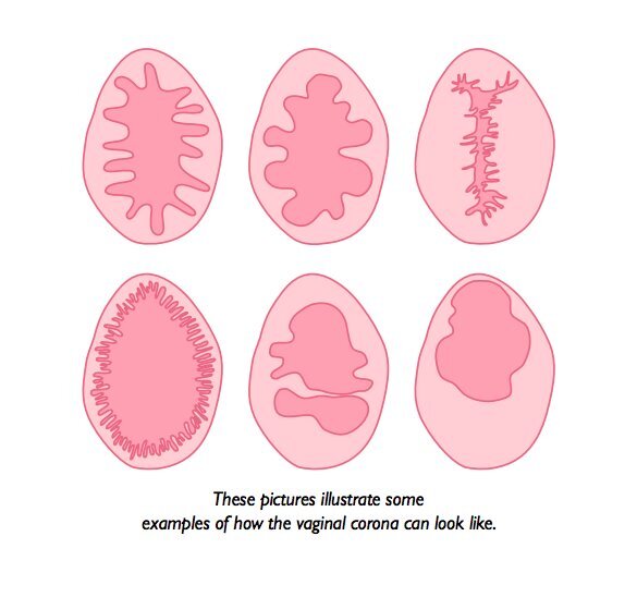 What The Inside Of Vagina Looks Like A Virgin