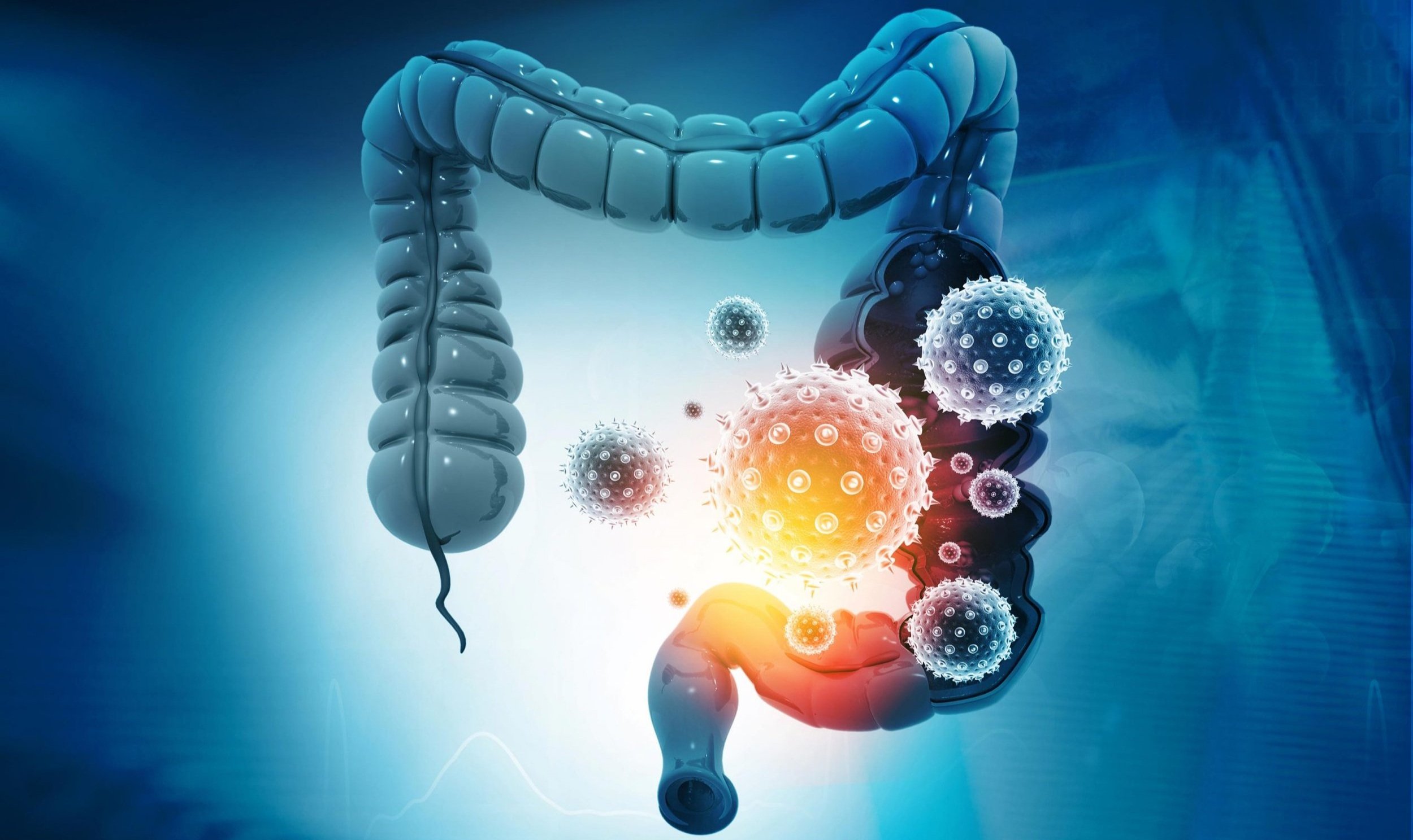 Can microbiomes in our gut lead to rheumatoid arthritis? — The Autoimmune  Registry