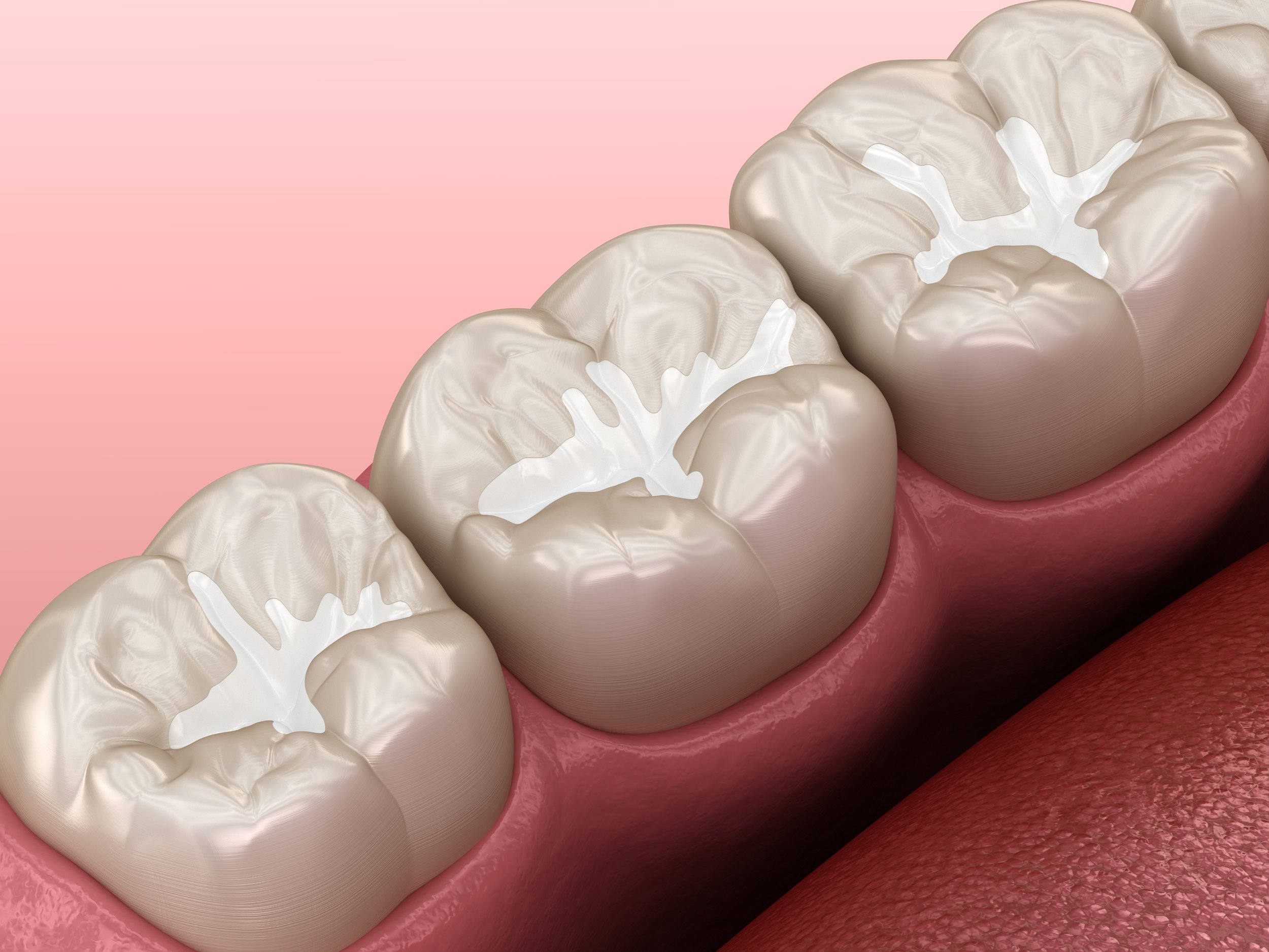 Advanced San Marcos Pediatric Dentistry: How We Use Atraumatic Restorative Treatment