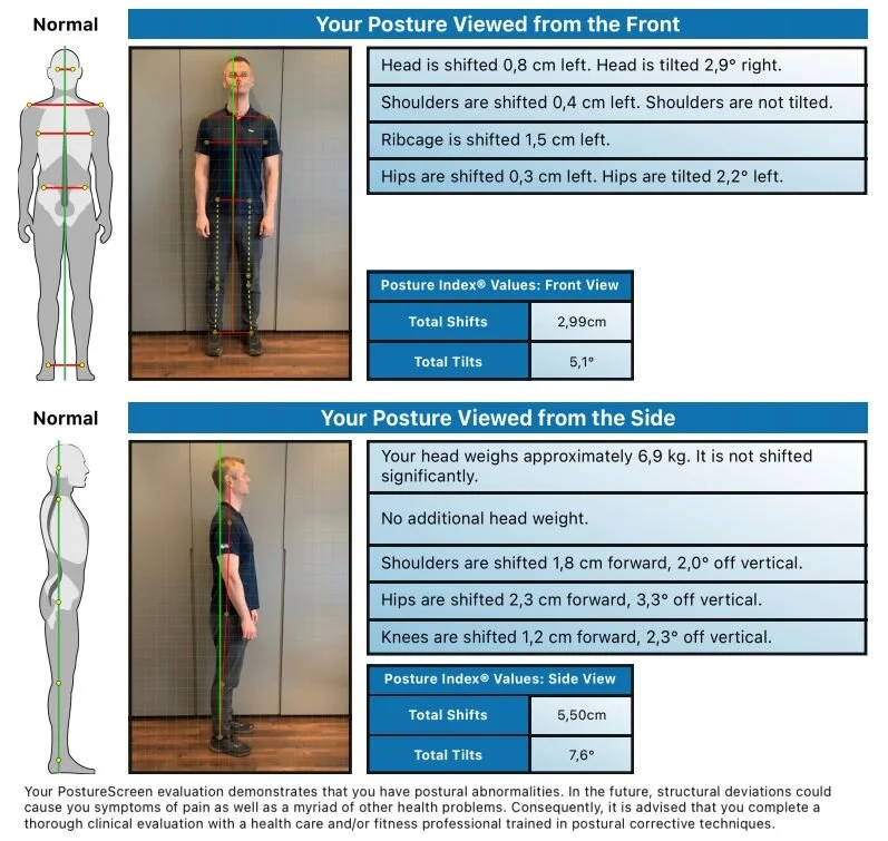 Dæmi um líkamsstöðupróf sem framkvæmt er við fyrstu heimsókn til kírópraktors á Kírópraktorstöðinni.