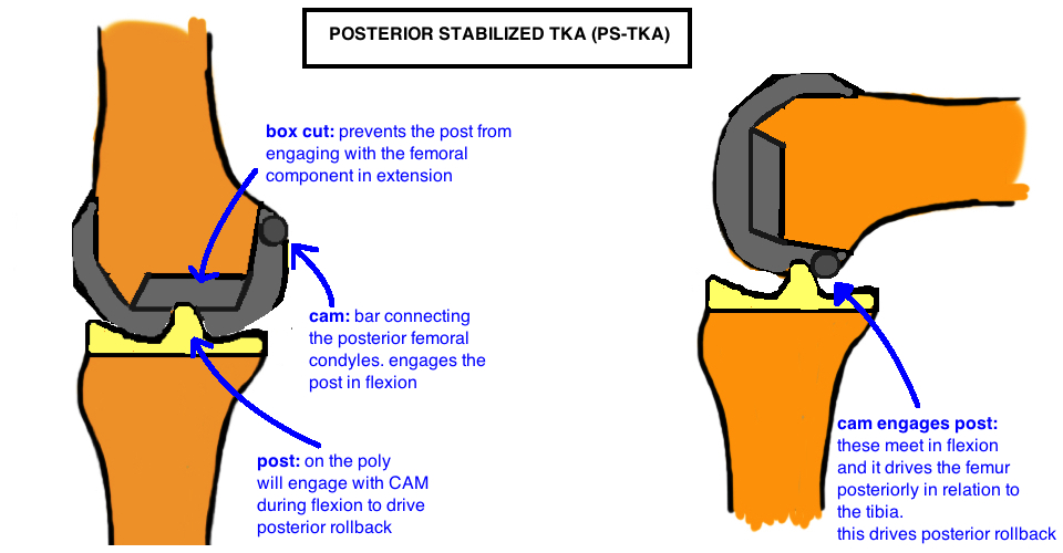 STEM: Press-Fit — Hip & Knee Book