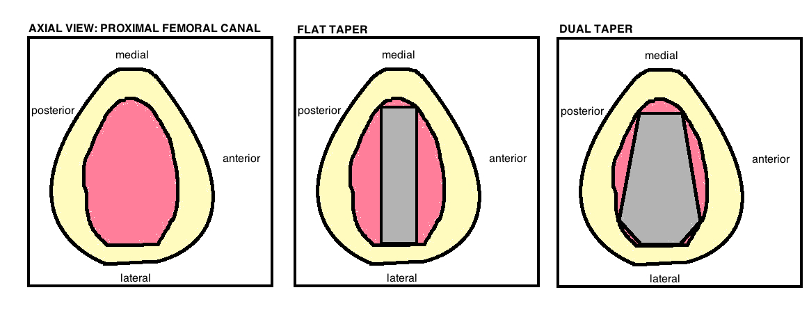 STEM: Press-Fit — Hip & Knee Book