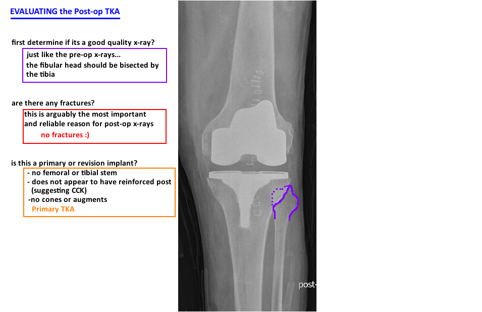 POSTOP EVALUATION — Hip & Knee Book