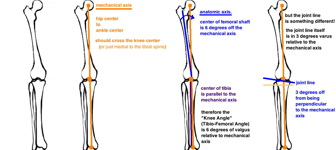 Native Knee Alignment Hip Knee Book Top selection of 2021 insole orthopedic varus, beauty & health, shoes, sports & entertainment, home & garden and more for 2021! native knee alignment hip knee book