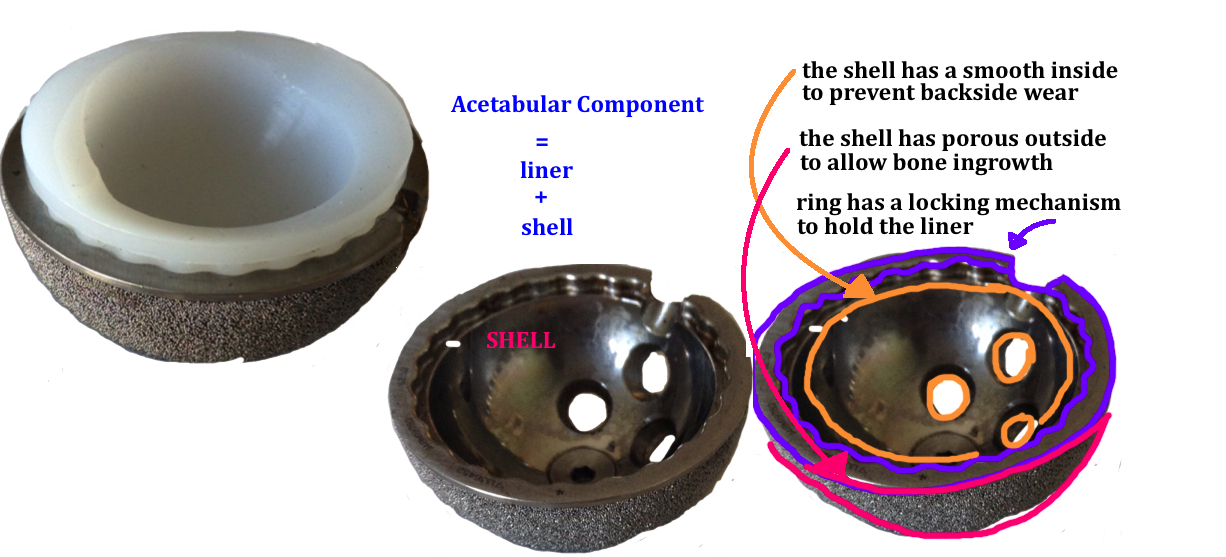 ACETABULUM SHELL — Hip & Knee Book