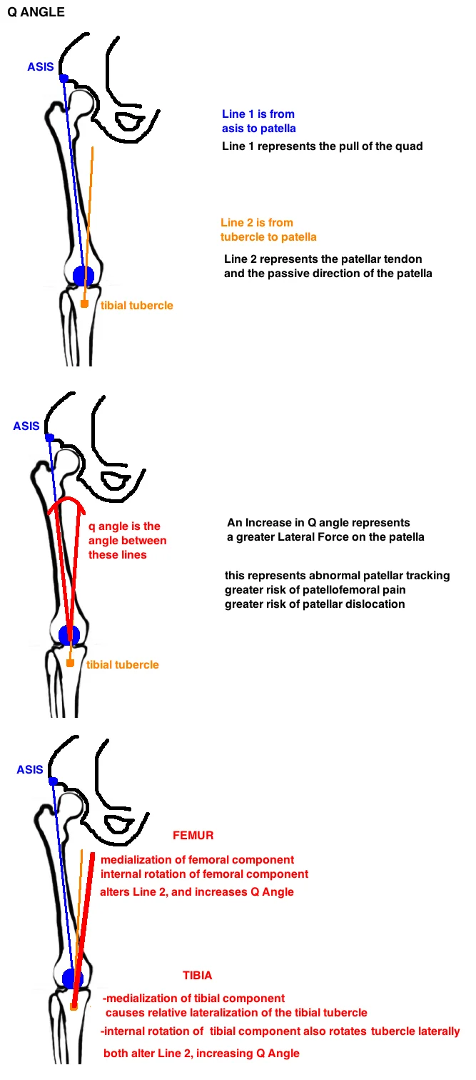 Lateral Tracking Patella Icd 10 – DXCF