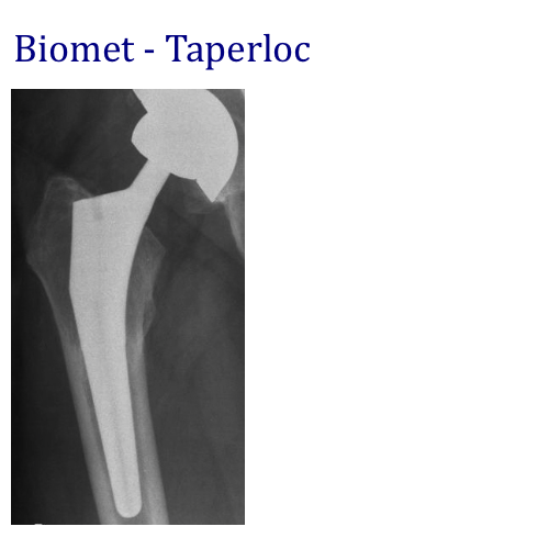 IMPLANT ATLAS — Hip & Knee Book