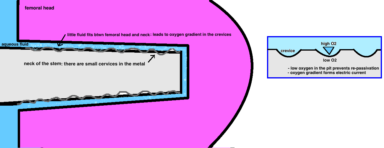 Crevice Corrosion prevents reformation of the passive layer
