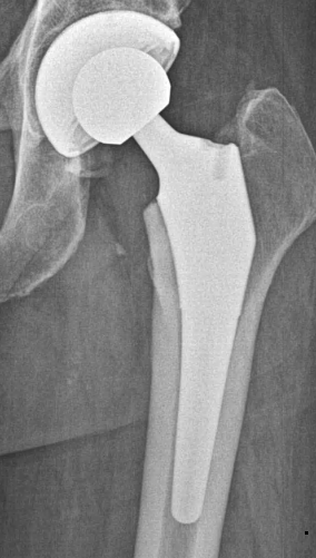 HIP SYSTEMS — Hip & Knee Book