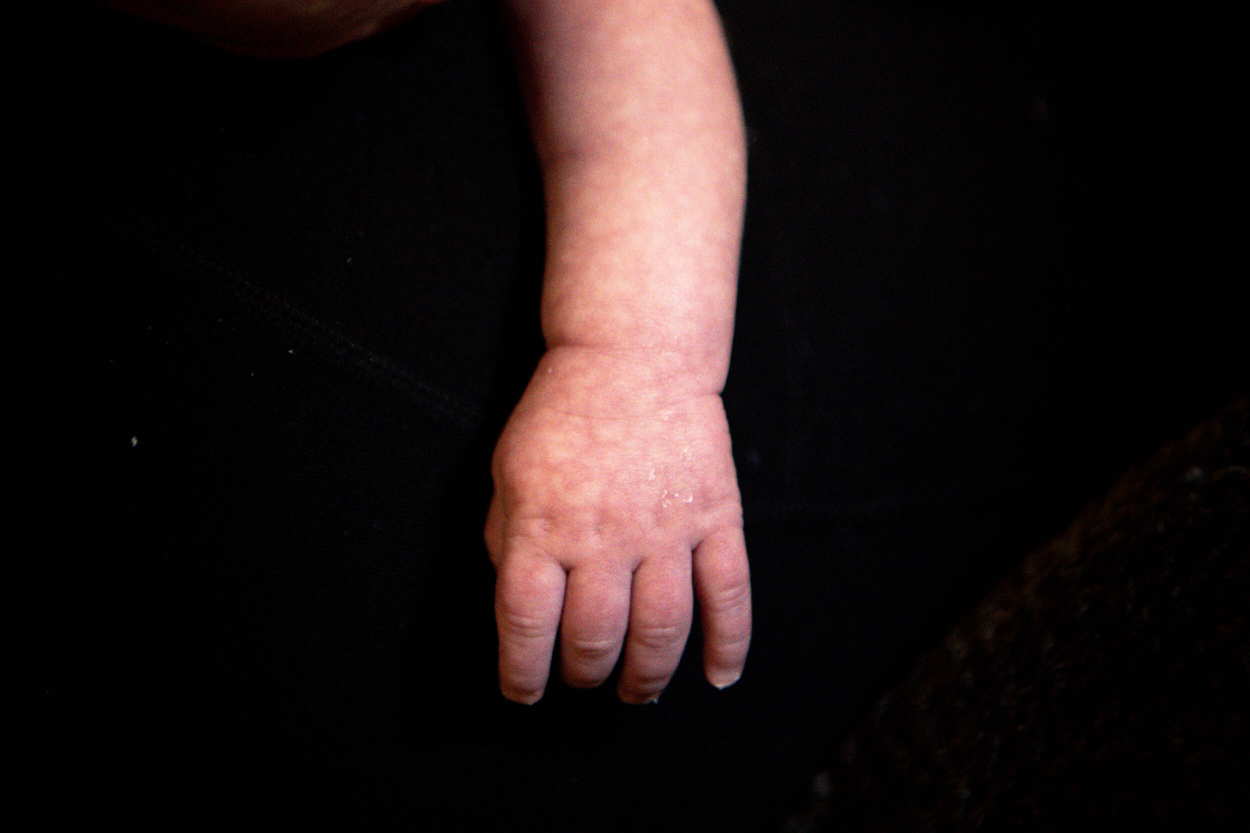  Henry Hudson Wehmeyer hangs his arm down during his 2-week-old checkup at his home outside Lebanon city limits.&nbsp; 
