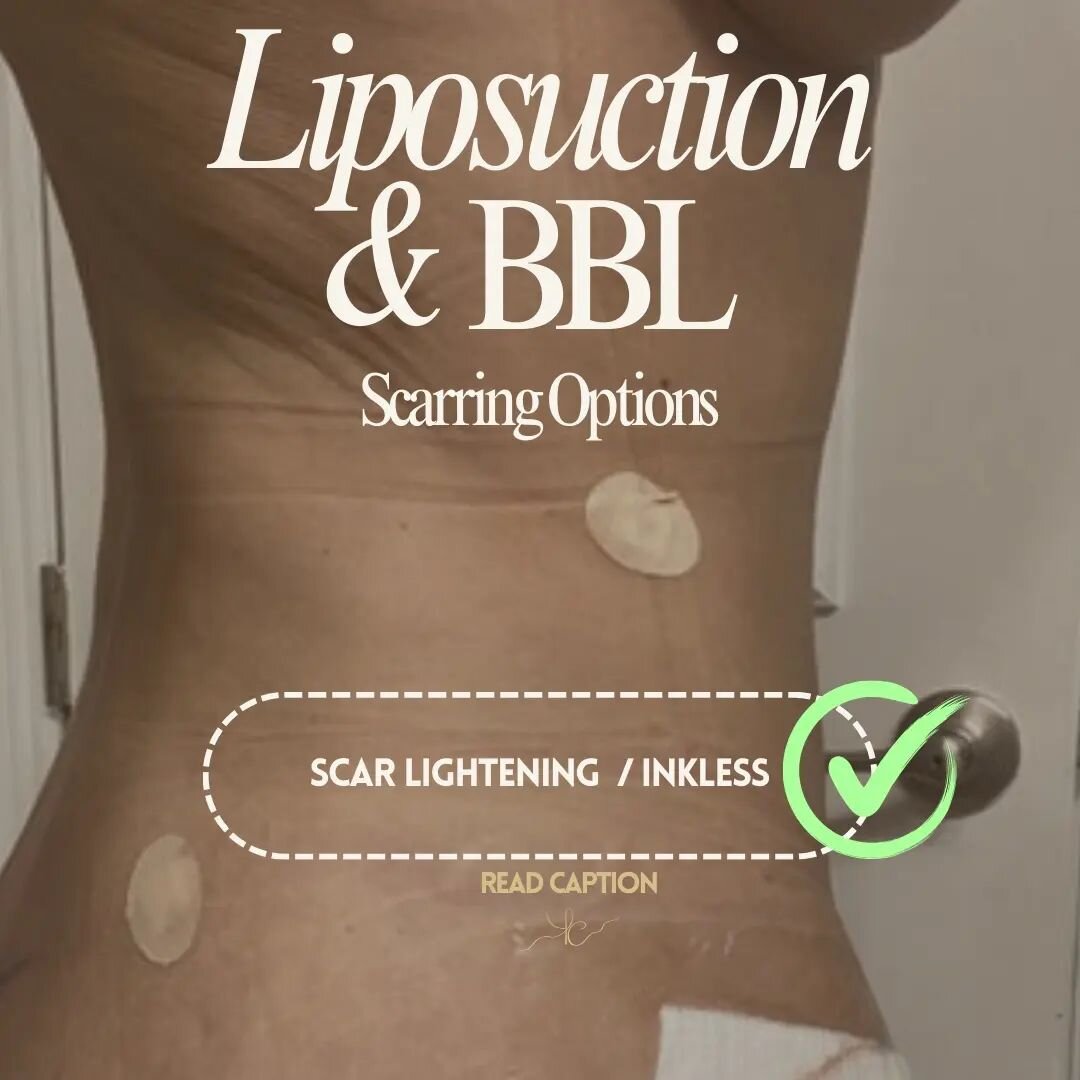 A lot of liposuction scars come through these doors, and are one of the easiest types of scar to treat with camouflage due to the small nature of them, there's a couple of different methods that can benefit them depending on the condition. 

Things t