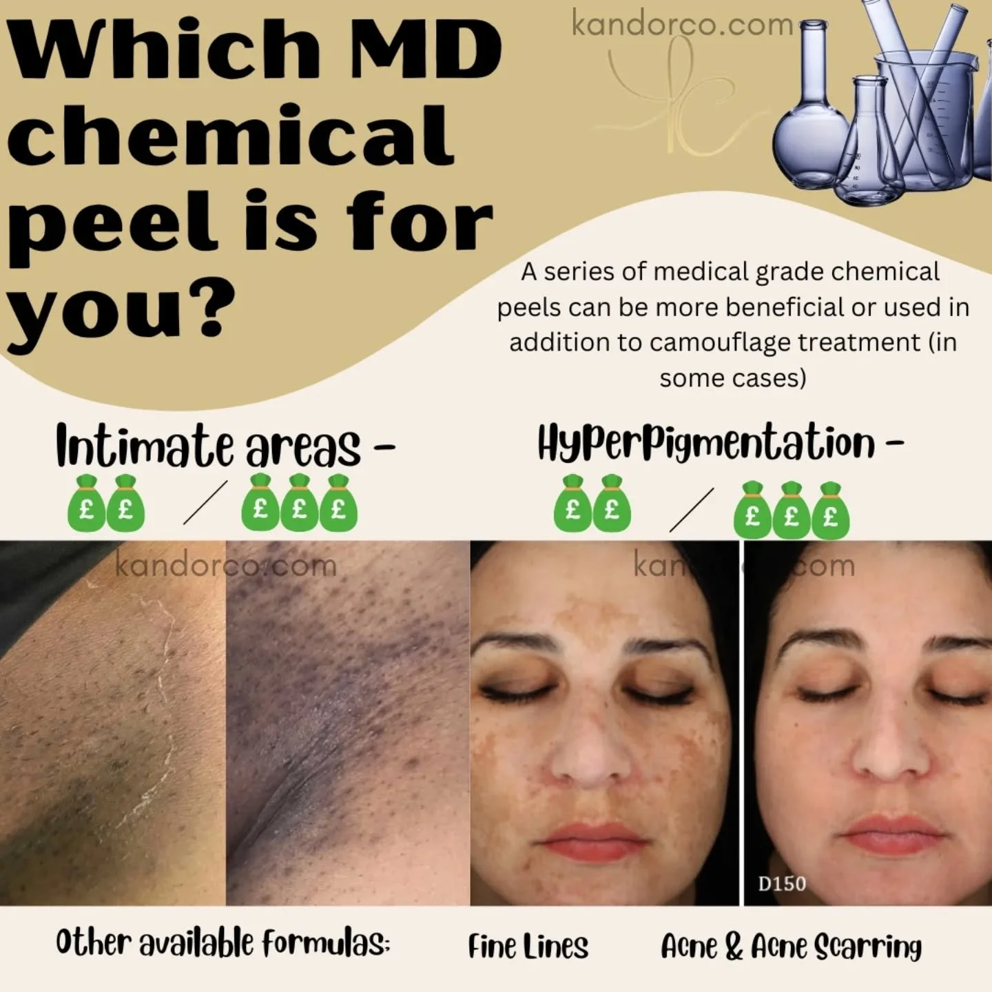Medical grade peels usually require pre prep work so make sure to follow the protocols for best results! 

Some of the main ingredients include Kojic acid, Phytic acid, Azaelic acid, Lactic acid, Salicylic acids. 

Depending on budget and lifestyle a