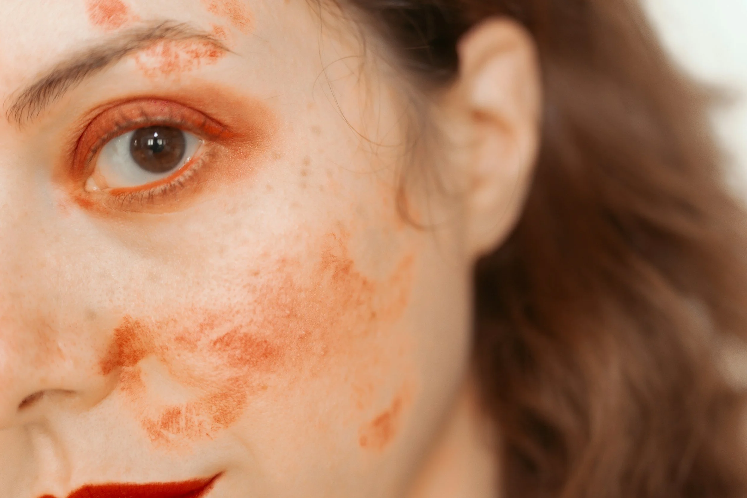 makeup for burns on face, cover burn scars with makeup, burn scar concealer UK, camouflage makeup for burns, how to cover burn scars face, makeup for burn survivors, full coverage for burn scars