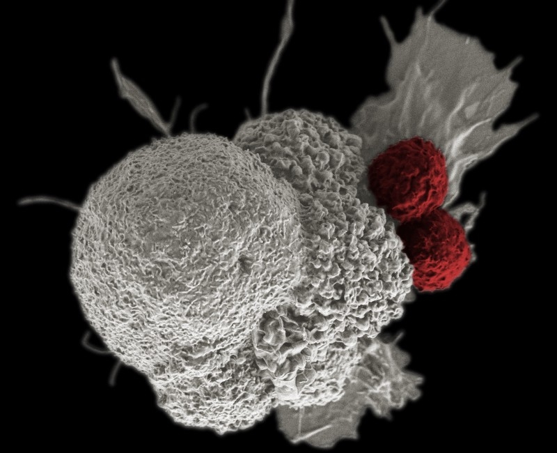 Photo courtesy of Creative Commons National Institute of Health Visible through an electron microscope, two T-Cells attack a cancer cell. This is one type of biological therapy offered as an alternative to chemotherapy.