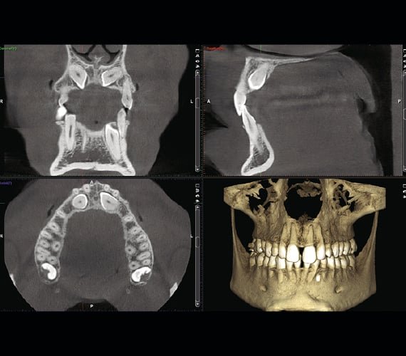 OPG and CBCT Scans