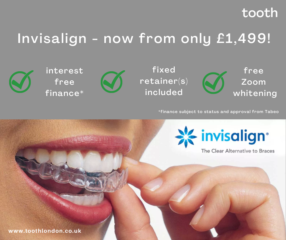 Image showing invisalign clear aligners and pricing at tooth dental care in Waterloo