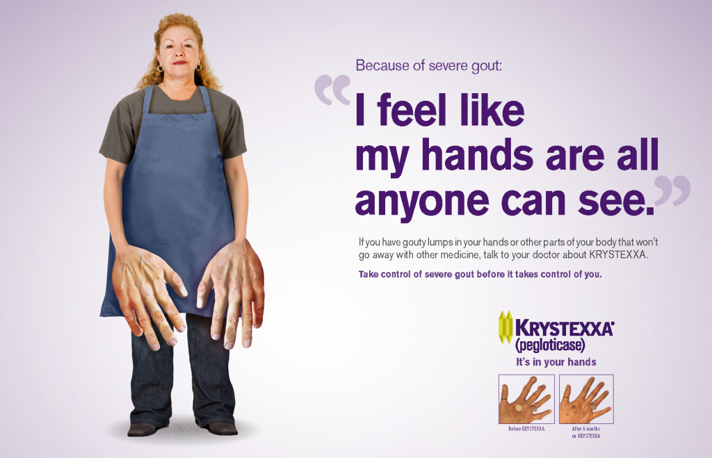 Print campaign for a Gout Drug