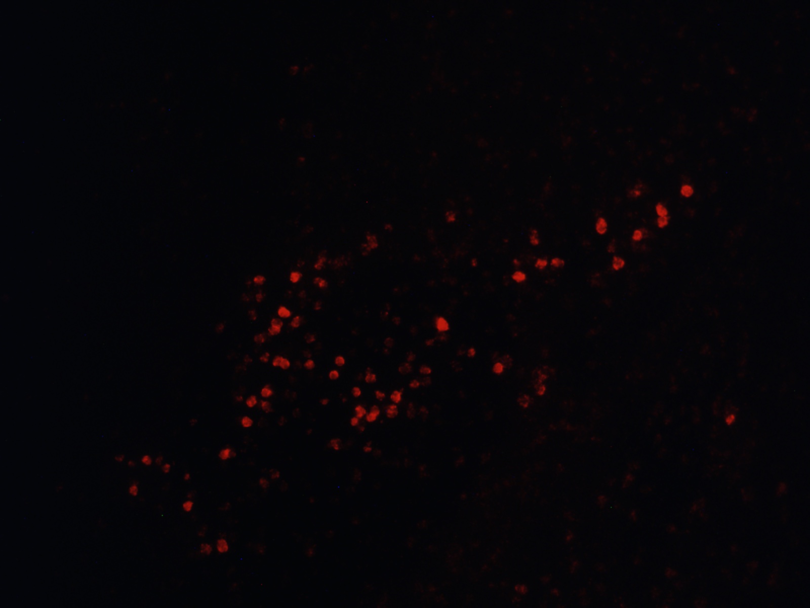CRF FISH CeA red.jpg