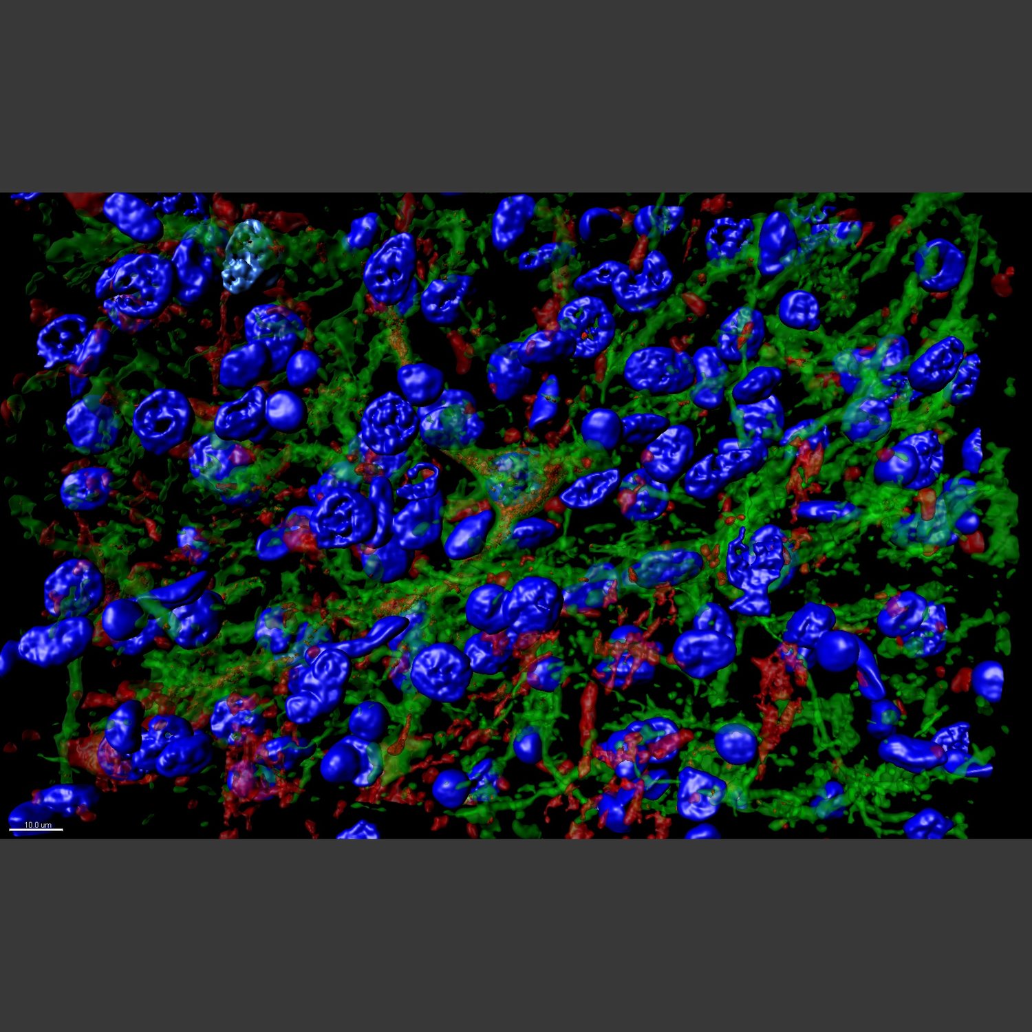 OPTO+CEA+GFPG+CRF-R+Dapi+63x-slide2a+-1z_001.jpg